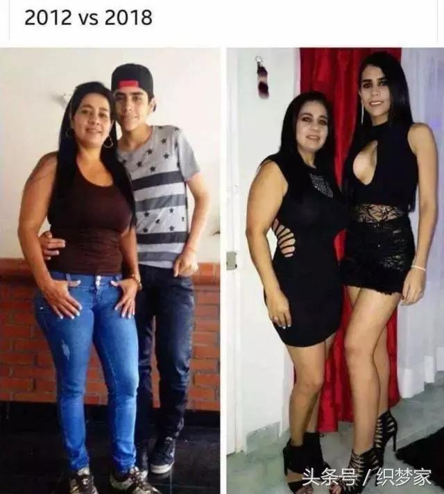 在海南被蚊子咬的包很久不消,老婆回老家被蚊子咬了怎么办