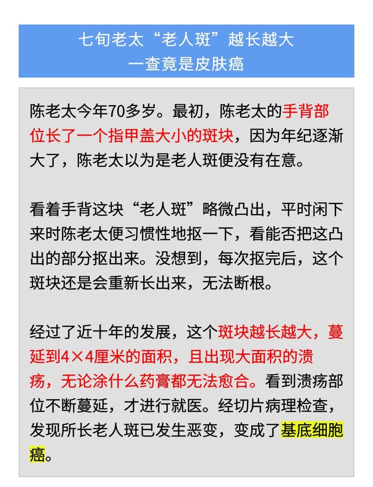 手背上起老年斑是癌症的前兆吗,老人斑越抠越大怎么办
