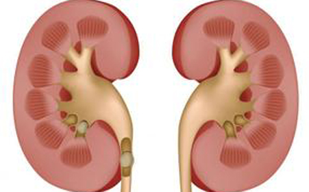 肾虚脾虚最有效方法,气血虚肾虚脾虚食补应该吃什么