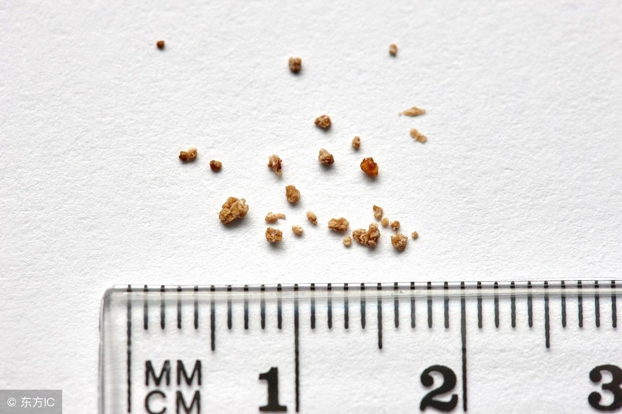 肾结石多少毫米能排石,肾结石多少mm会导致疼痛