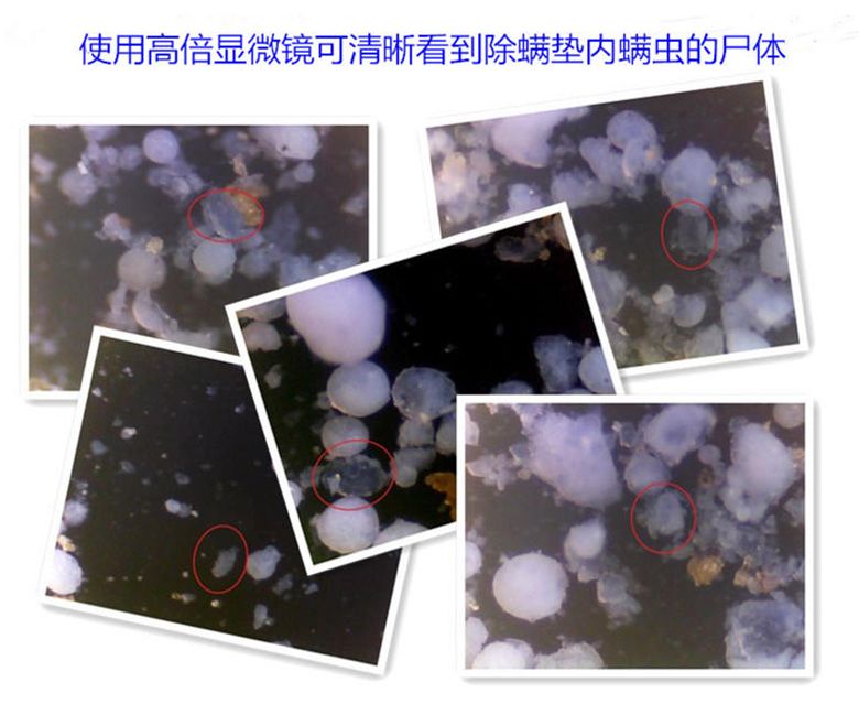 被子枕头如何除螨虫,消灭枕头上螨虫细菌的方法