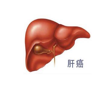 肝脏肿瘤最好的治疗方法是什么,肝脏多发性肿瘤是肝癌能活多久