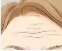 额头的几种纹路代表你好运又好命,贫富天注定额头这些纹路大有玄机