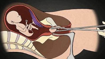 微信新套路：给男朋友发这句话，看他会怎么回复你？