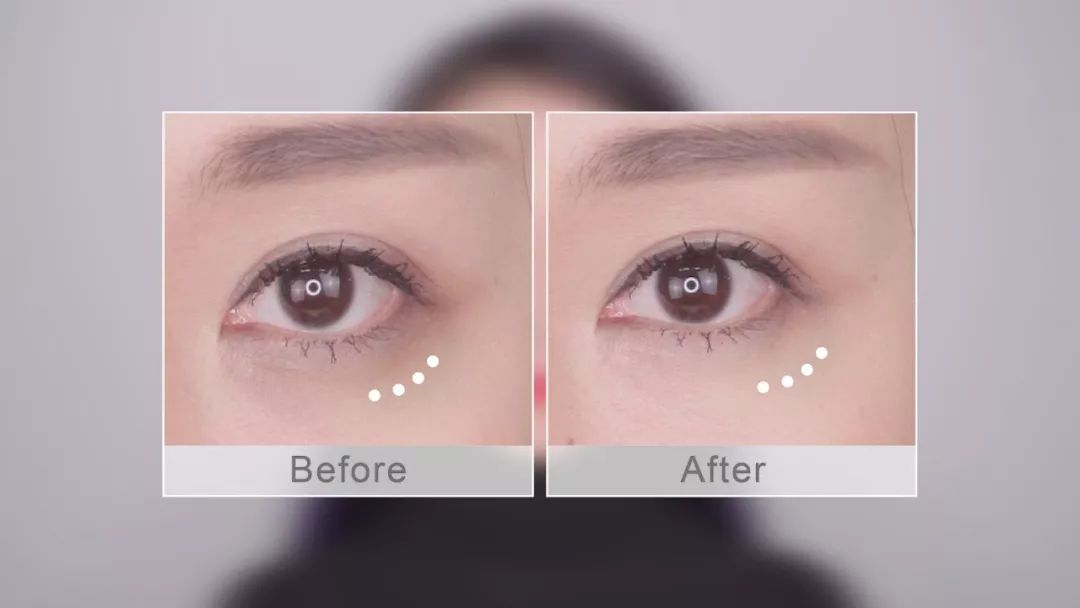 陆毅贝儿眼膜,陆毅用的眼膜