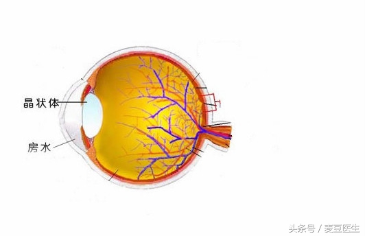 糖尿病引发的白内障最佳治疗方法,糖尿病人患有轻微白内障怎么治疗