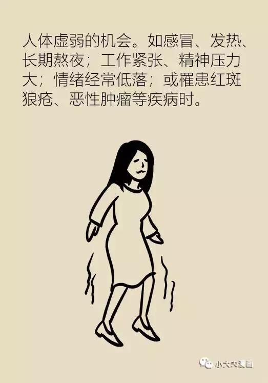 协和医院可以打带状疱疹疫苗吗,协和医院带状疱疹专家