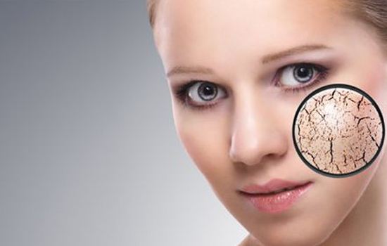 女性皮肤干燥怎么办,推荐几个食疗方法解决皮肤干燥问题