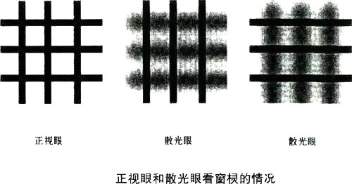 小孩散光挂眼科的哪种门诊,幼儿园体检散光2.0