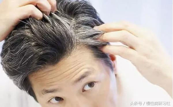 人还没到老就有白头发,人还没老呢头先秃