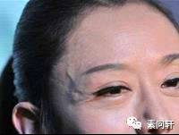 像蚯蚓一样的凸起的纹,像蚯蚓一样黑色的是什么