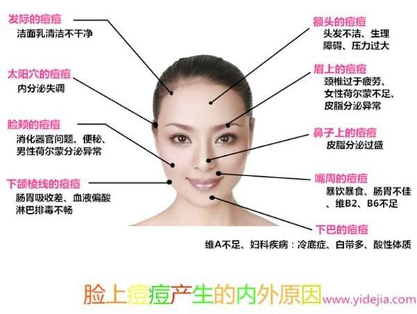 下巴周围反复长痘痘是什么原因,下巴痘痘反复长是什么原因