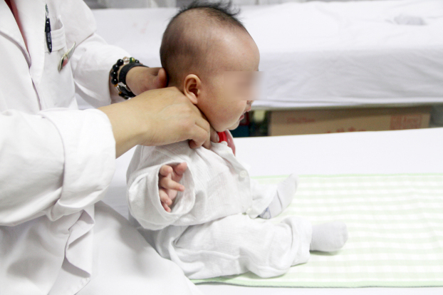 小儿斜颈推拿治疗费用能不能报销,小儿斜颈推拿治疗方法