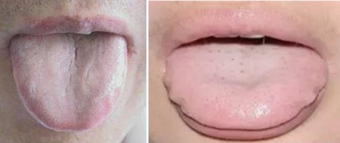 吃饭不消化肚子胀怎么回事,肚子胀不饿怎么治疗