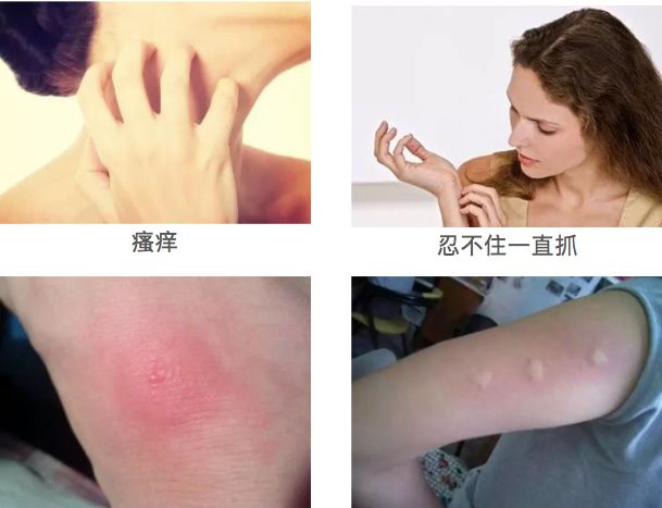 泰国驱蚊提神的好处,泰国青草膏驱蚊止痒