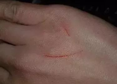 被狗猫抓伤要不要打疫苗,被家养的打过狂犬疫苗的猫抓伤