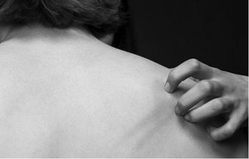 夏天湿疹最简单的自愈方法,夏天湿疹怎么治能去根