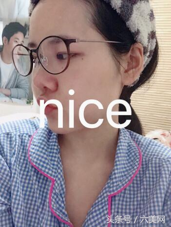 隆鼻后如何克服焦虑,隆鼻后前三天状态