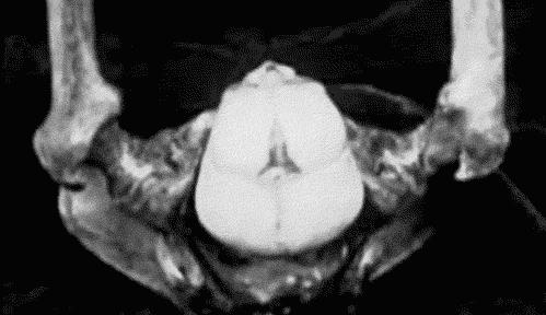 大姨妈是什么生理机制,大姨妈意味着什么意思