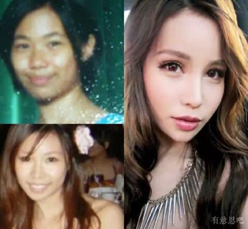 你如何看待整形手术后果,你对整形这件事情怎么看