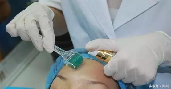 治疗痘坑的微针品牌,家用抗皱美白祛斑微针