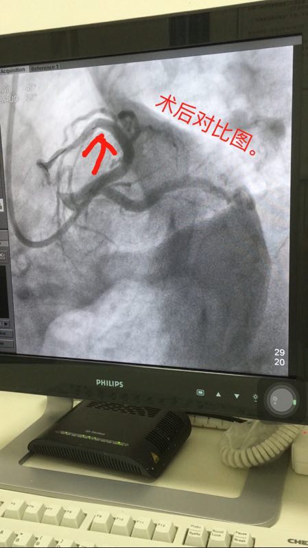 妊娠期d类药物对胎儿有什么影响,药物对妊娠影响等级