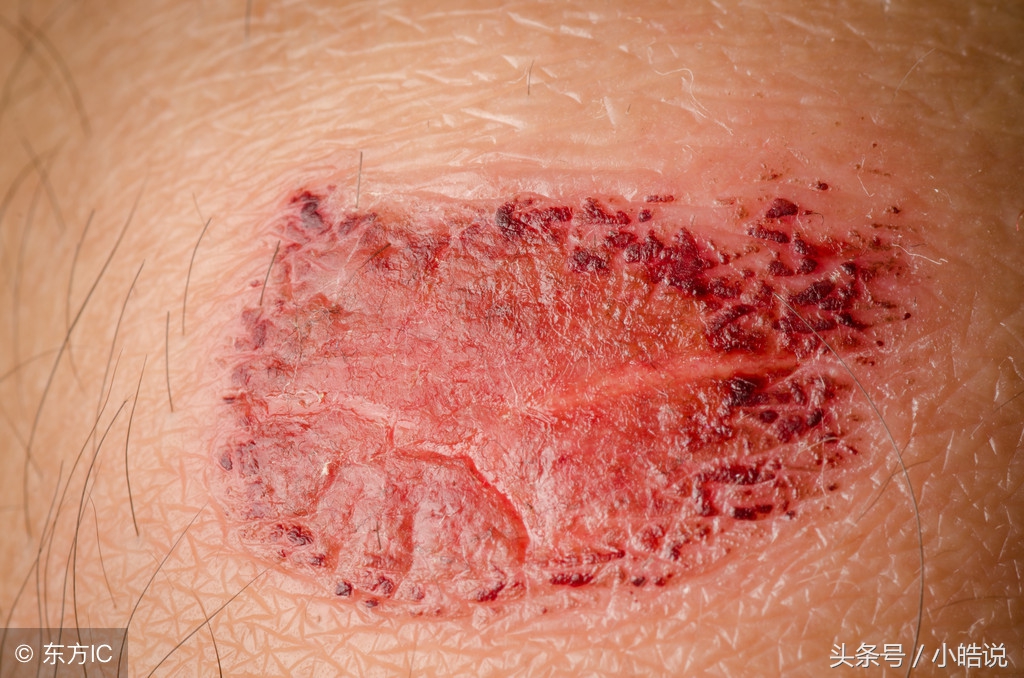 冷知识什么植物不能碰,冷知识什么植物不能闻