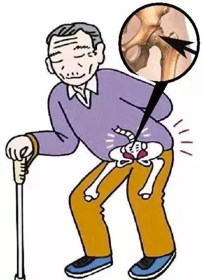 老年人关节老化需要做手术吗,老年人关节老化要动手术吗