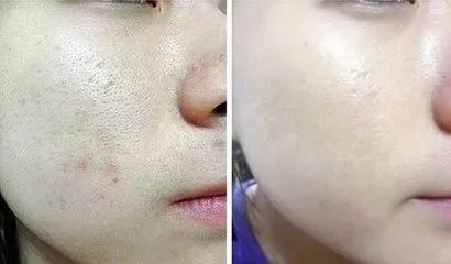 雅诗兰黛密集修护面膜和sk2面膜,雅诗兰黛专柜面膜