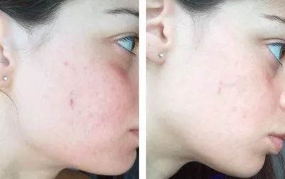 国货湿敷水补水保湿平价,湿敷提亮水大瓶推荐