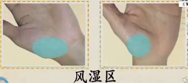 手上的健康秘密,手诊10种常见病从手上就能看出来