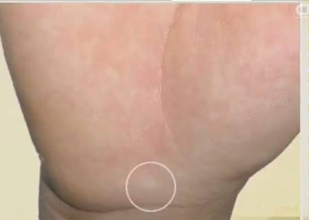 手是健康的镜子,手的健康识别