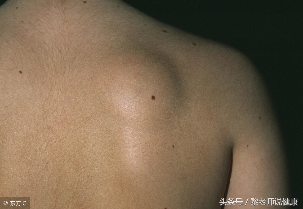 酸性食物能消除脂肪吗,酸性体质多吃面食管用吗