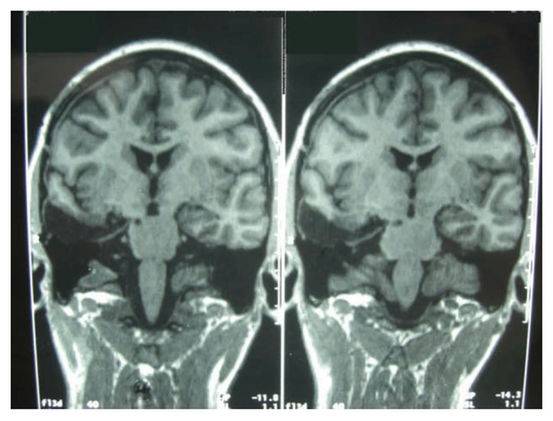 阴茎纹身还有这用处？医生应该见识的22个奇葩病例
