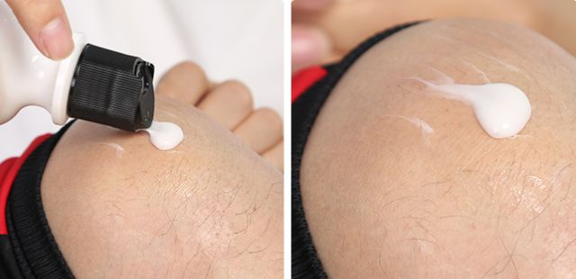 PP、腋下、手肘、三角区发黑暗沉？日本女*爱性**用好物，抹一抹，4周白嫩如少女！