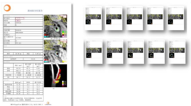 识别易损斑块方法,从了解到熟练五个阶段
