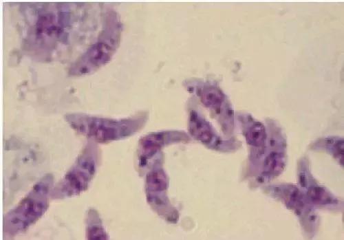 黄瓜中有杀不死的寄生虫，这条谣言你信了吗？挑选黄瓜请注意