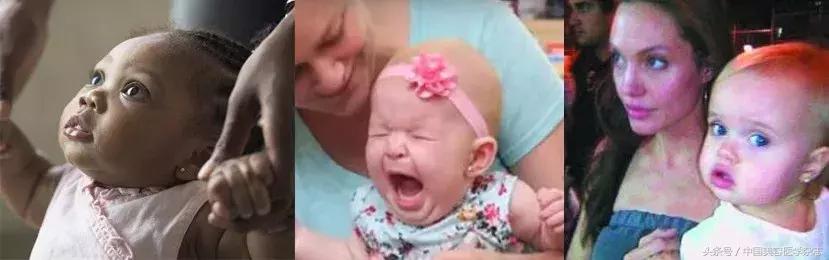 打的耳洞很久了有臭臭的分泌物,耳洞怎么总是臭臭的