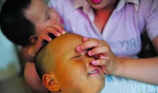 风疹病毒会导致胎儿什么畸形,风疹病毒导致胎儿先天性心脏病吗