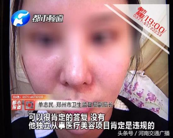 女子整容鼻子凹下去了,女子整容整个脸变毁容不敢出门