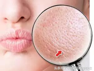 毛孔粗大修复小妙招不要护肤品,毛孔粗大怎么修复不花钱
