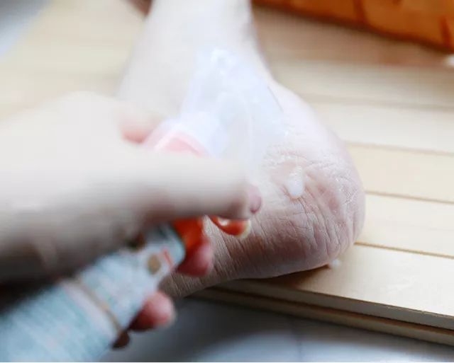 擦掉一张皮，双脚换皮术！死皮、老茧一喷就没，15秒还原嫩白玉足