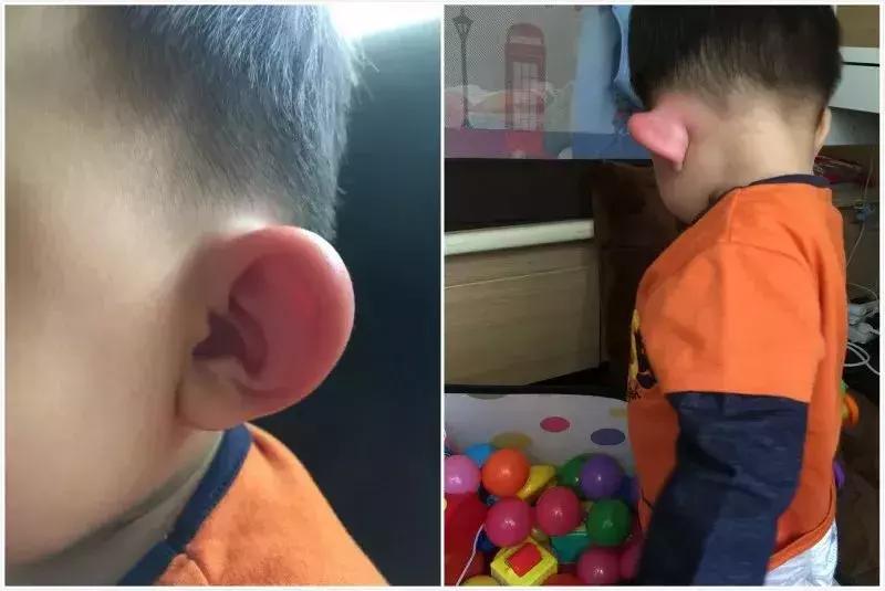 宝宝青草膏抑菌膏,止痒膏第一名青草膏