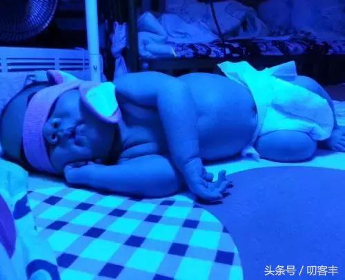 新生儿溶血检测报告单,母亲o型血新生儿溶血