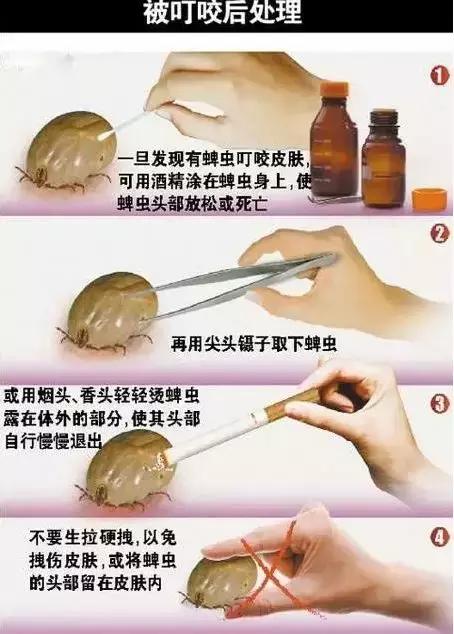 蜱虫咬人致死率多少,每年蜱虫咬人死亡率