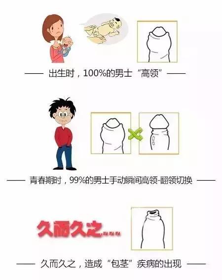 30岁做包皮手术做哪种最合适,30岁的男人适合做包皮手术吗