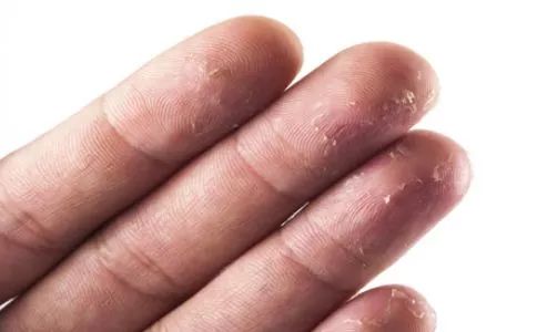 林允回应撕脚皮事件,林允撕脚皮用的是什么