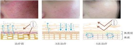 爱是一道光束,爱是一道光量子力学