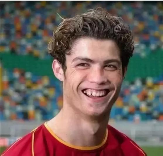 c罗容貌的变化,c罗整牙颜值变化