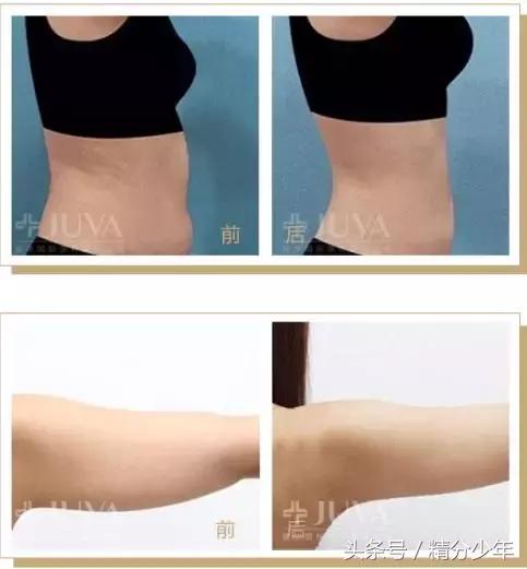 顽固性易胖体质怎么瘦下去,145斤易胖体质能瘦下来吗